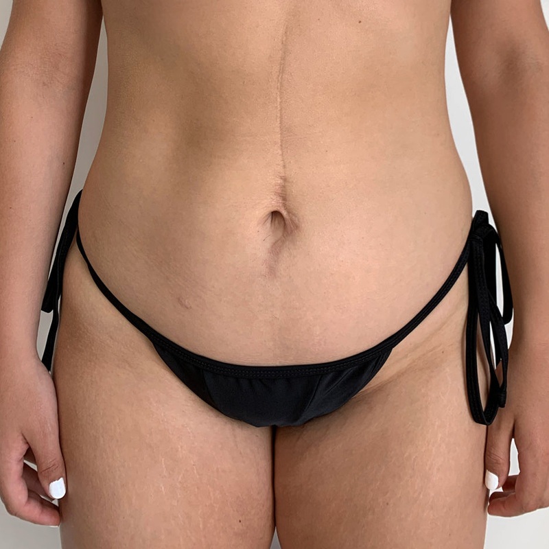 Black Ecohoaka Bottoms – Final Sale